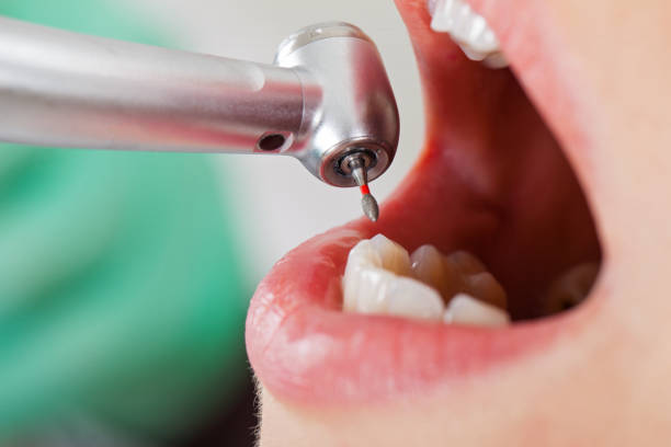Best Broken or Chipped Tooth Repair in St Stephens, NC
